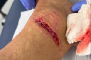 丹索：迪涅在場邊我向他道了歉，確實碰到了他，但我明顯先清了球