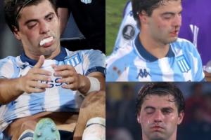 被打懵了！羅霍解放者杯不慎肘擊誤傷隊(duì)友，后者眼部腫了鼻子流血